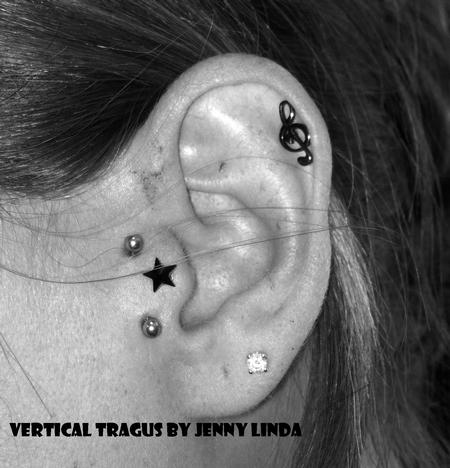  - verticaltragus