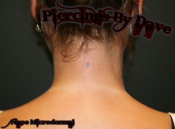 Dave Meth - Nape Microdermal 