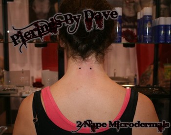 Dave Meth - Nape Microdermals 