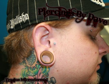 Dave Meth - Tragus Microdermal 