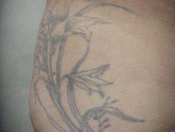 Bad Tattoos - Flowers....